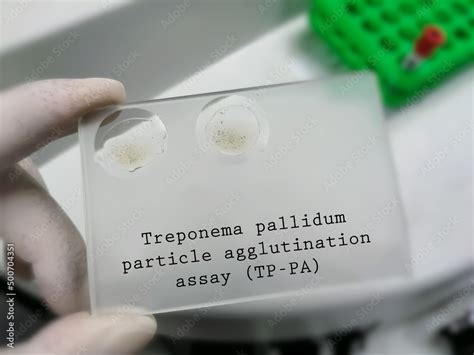 tp udom|Iba pa.